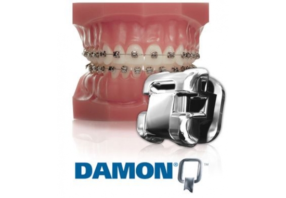 брекеты Damon Q