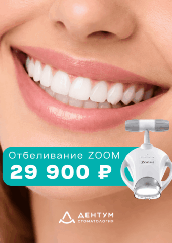 Отбеливание зубов ZOOM 4 — 29 900 ₽